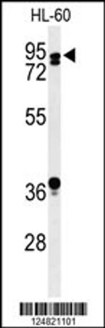 Western blot analysis of PATL1 Antibody in HL-60 cell line lysates (35ug/lane)