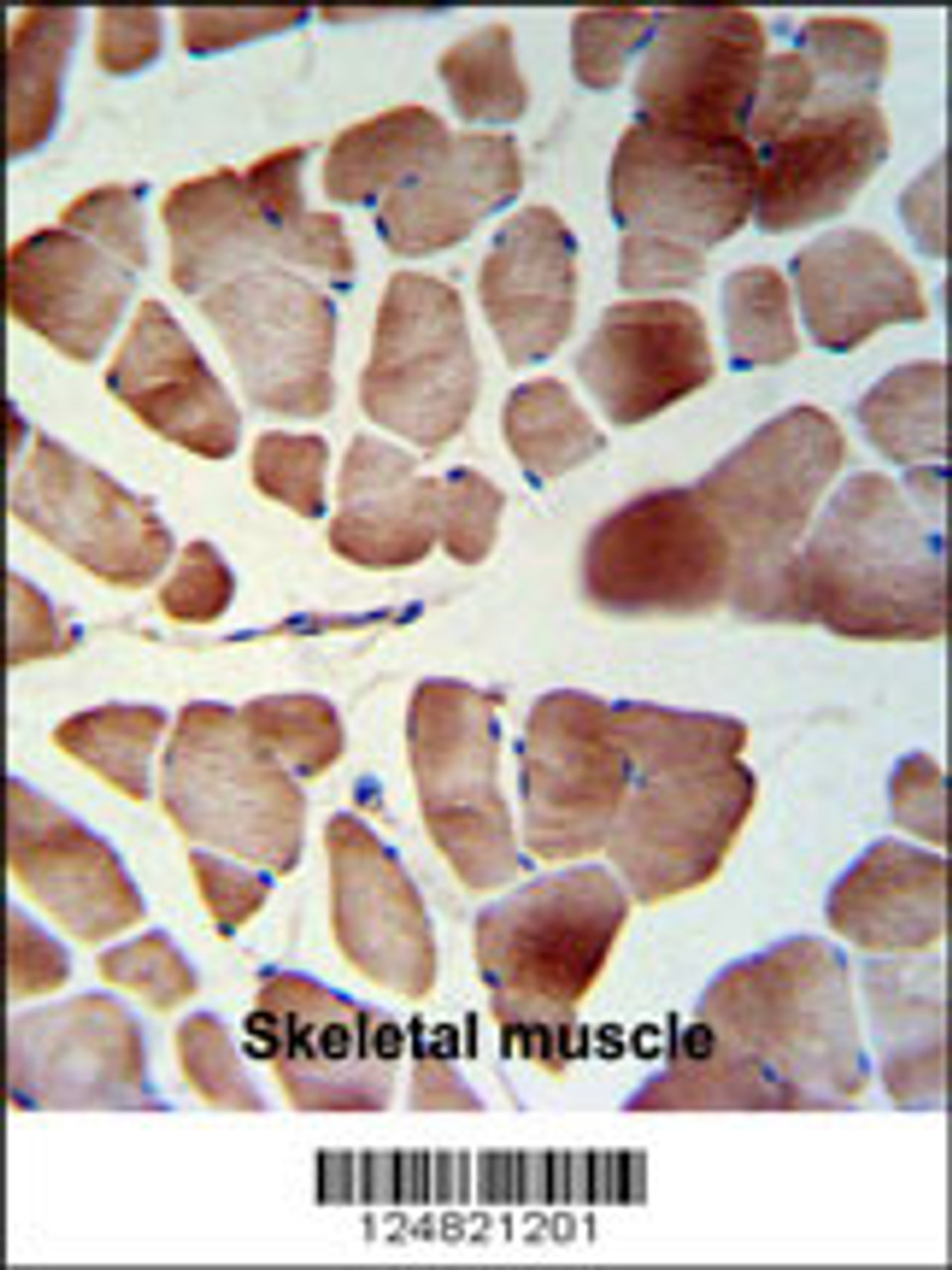 PATL1 Antibody IHC analysis in formalin fixed and paraffin embedded skeletal muscle followed by peroxidase conjugation of the secondary antibody and DAB staining.