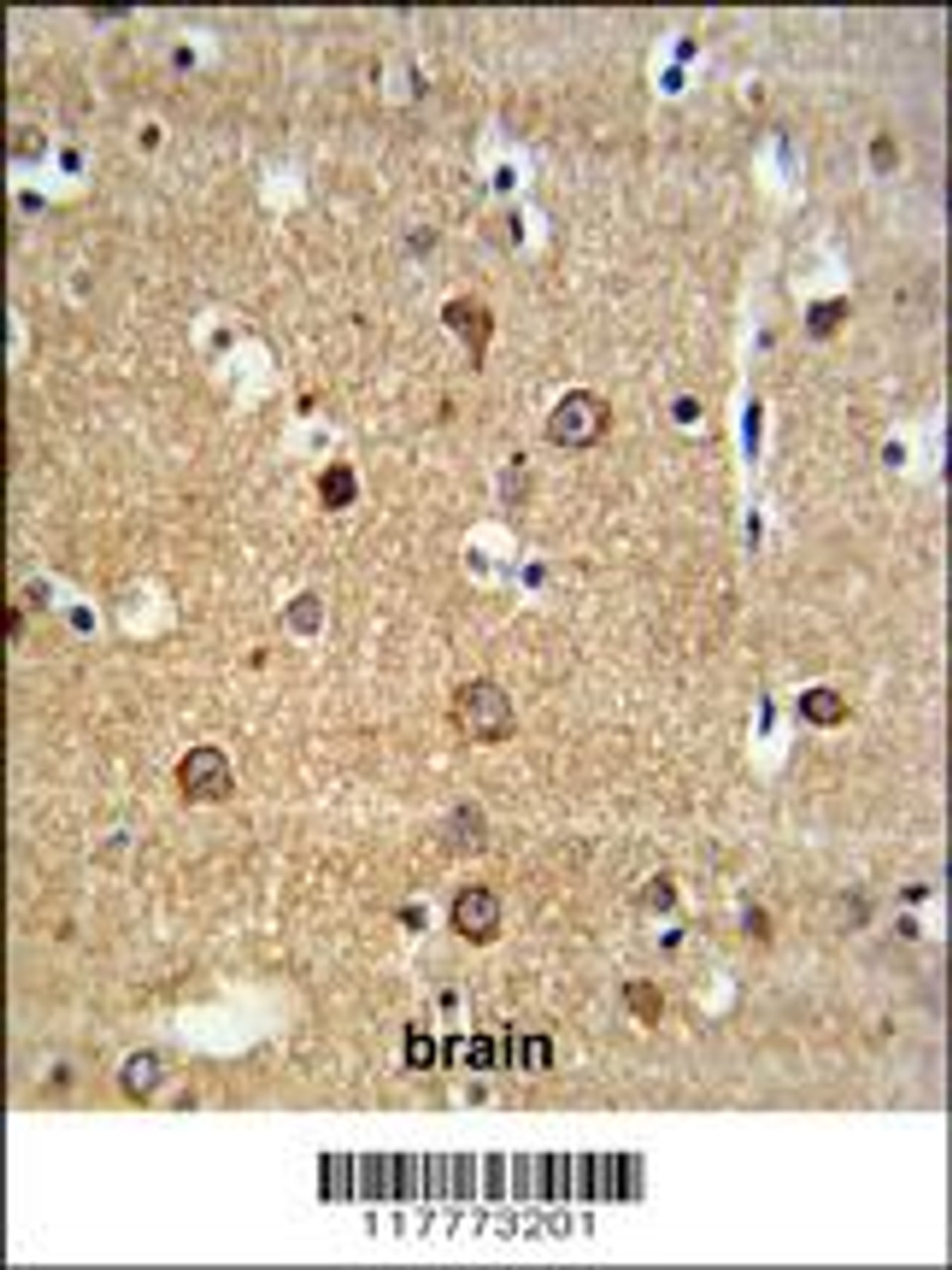 ADAM19 Antibody IHC analysis in formalin fixed and paraffin embedded brain tissue followed by peroxidase conjugation of the secondary antibody and DAB staining.