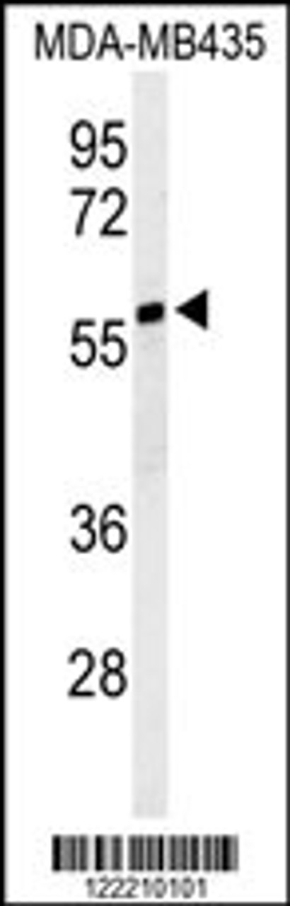 Western blot analysis of NARFL Antibody in MDA-MB435 cell line lysates (35ug/lane)
