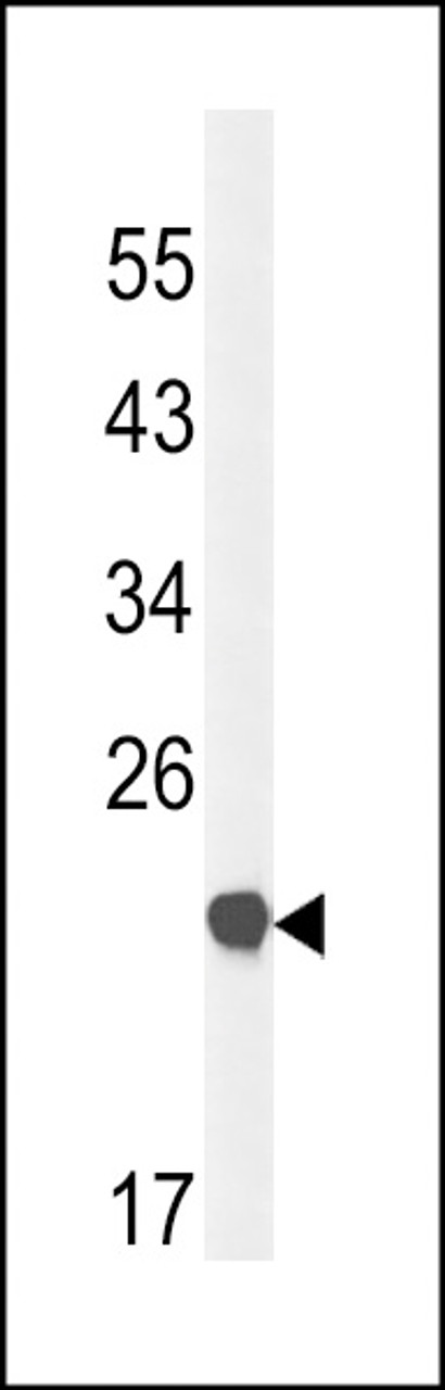 Western blot analysis of CLDN23 Antibody in mouse bladder tissue lysates (35ug/lane)