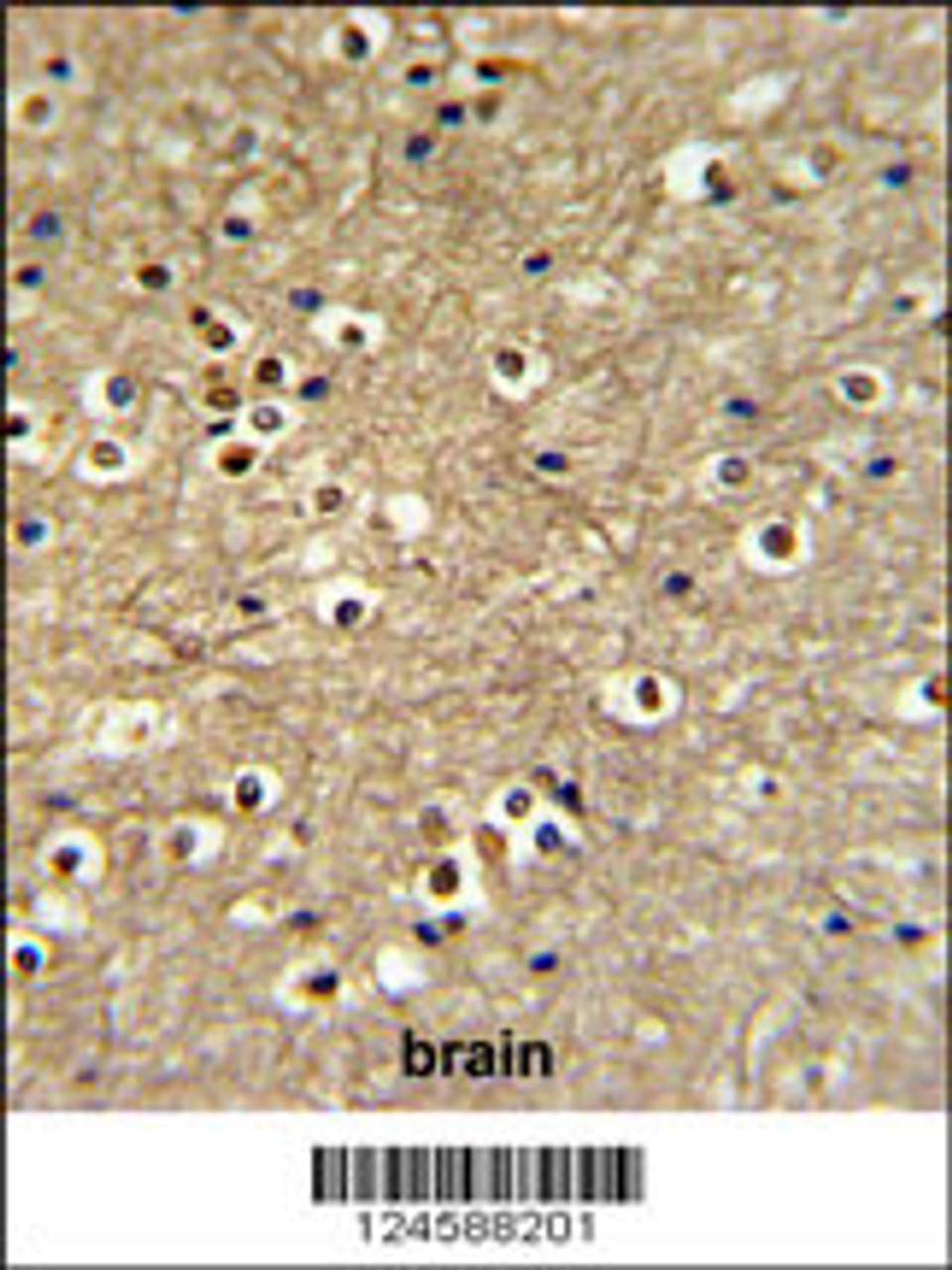 ETS2 Antibody IHC analysis in formalin fixed and paraffin embedded brain tissue followed by peroxidase conjugation of the secondary antibody and DAB staining.