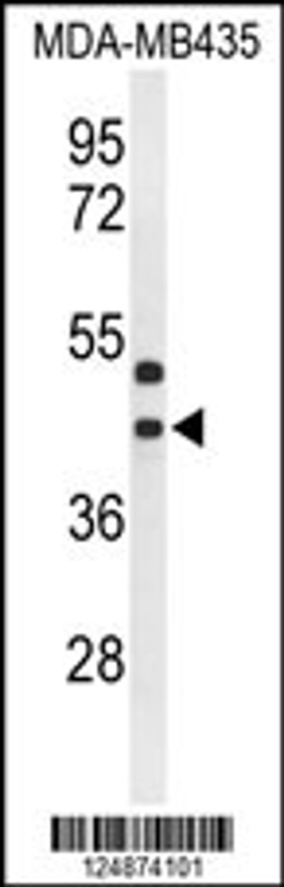Western blot analysis of GPR17 Antibody in MDA-MB435 cell line lysates (35ug/lane)