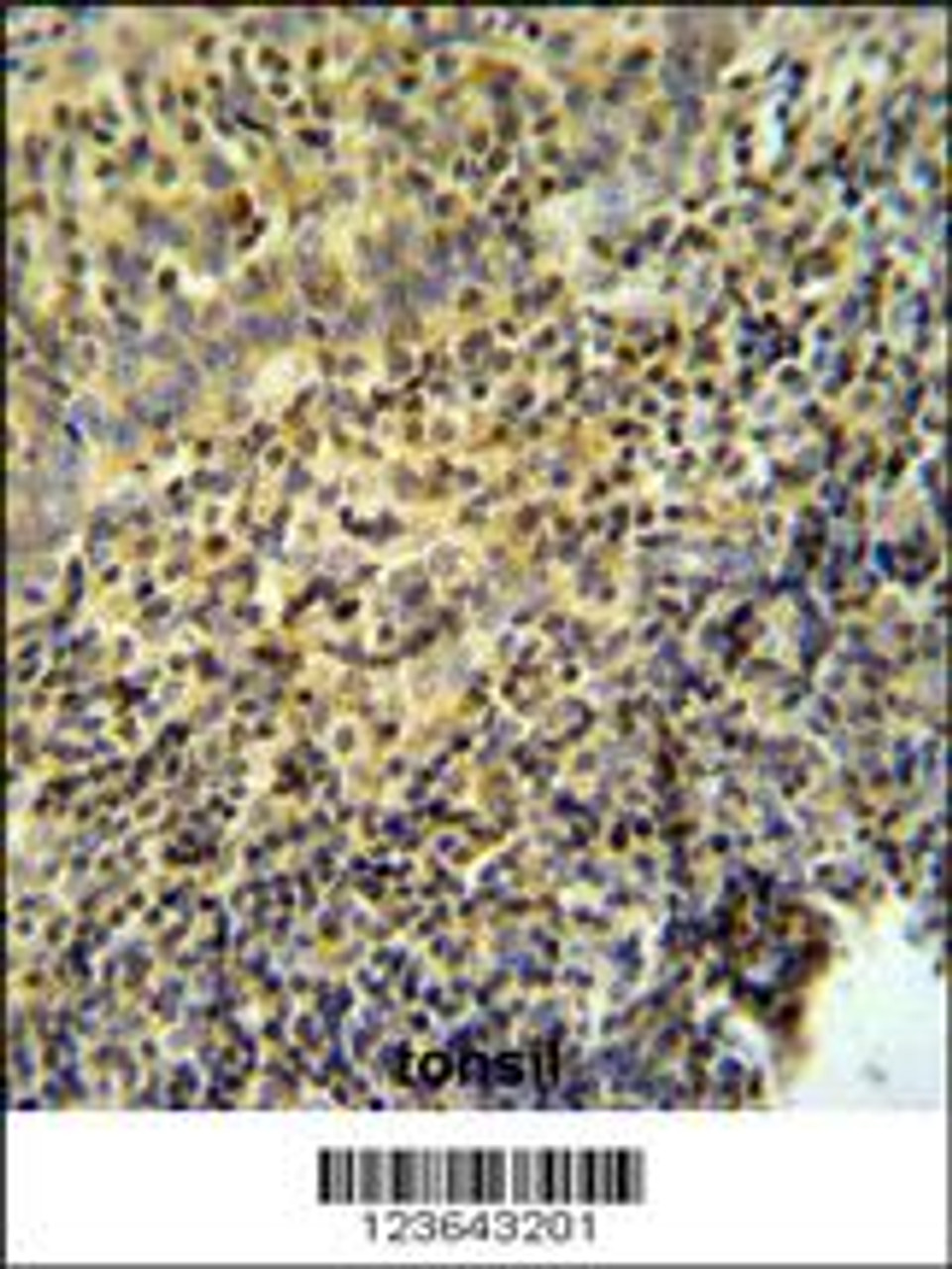 WAS Antibody IHC analysis in formalin fixed and paraffin embedded tonsil tissue followed by peroxidase conjugation of the secondary antibody and DAB staining.