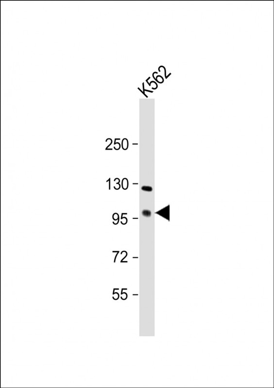 Western Blot at 1:500 dilution + K562 whole cell lysate Lysates/proteins at 20 ug per lane.