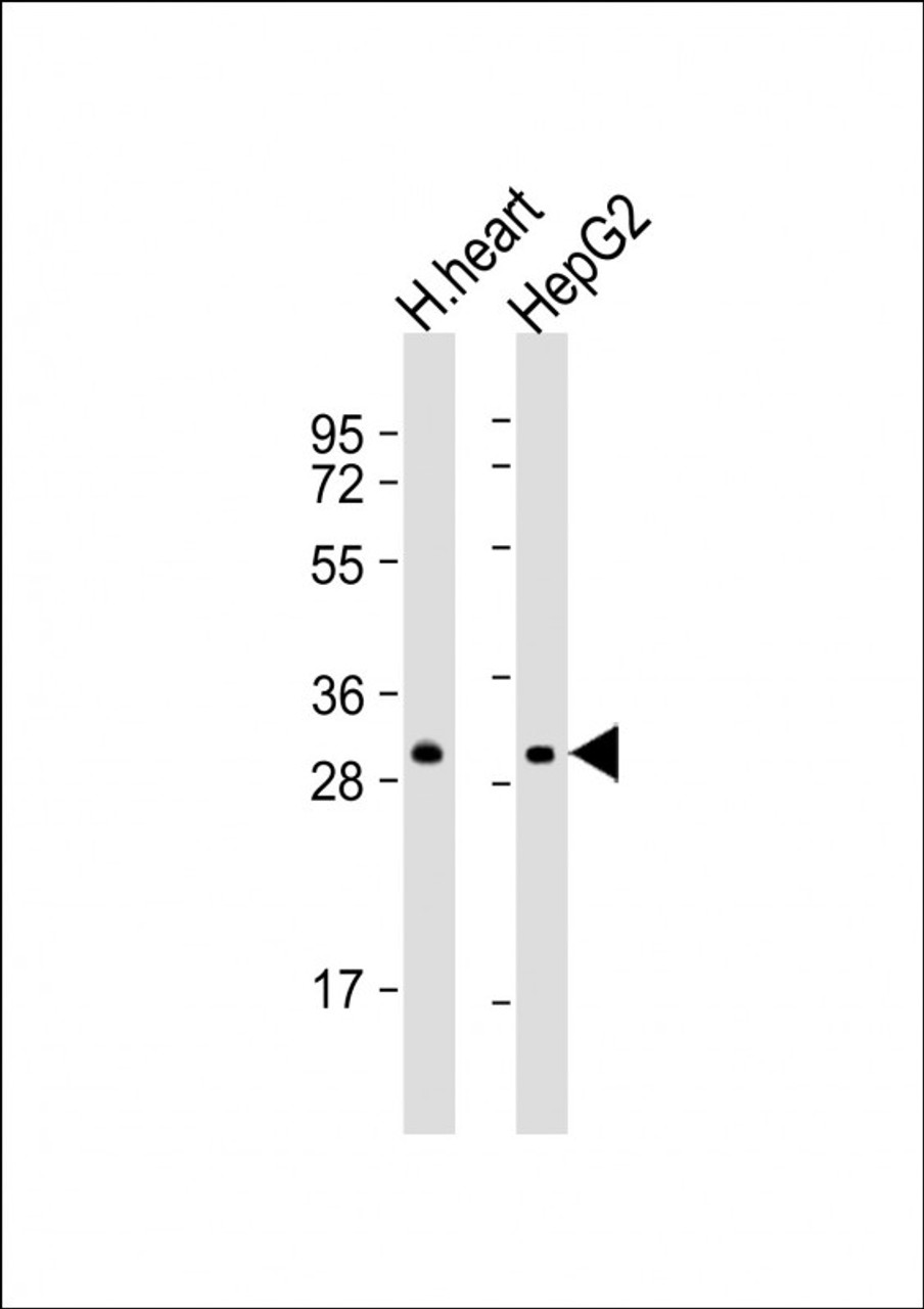 Western Blot at 1:4000 dilution Lane 1: human heart lysate Lane 2: HepG2 whole cell lysate Lysates/proteins at 20 ug per lane.