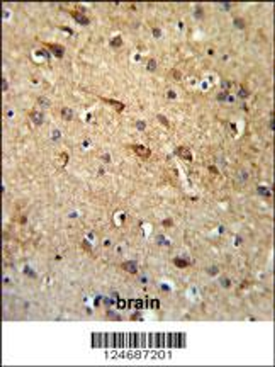 RGR Antibody IHC analysis in formalin fixed and paraffin embedded brain tissue followed by peroxidase conjugation of the secondary antibody and DAB staining.