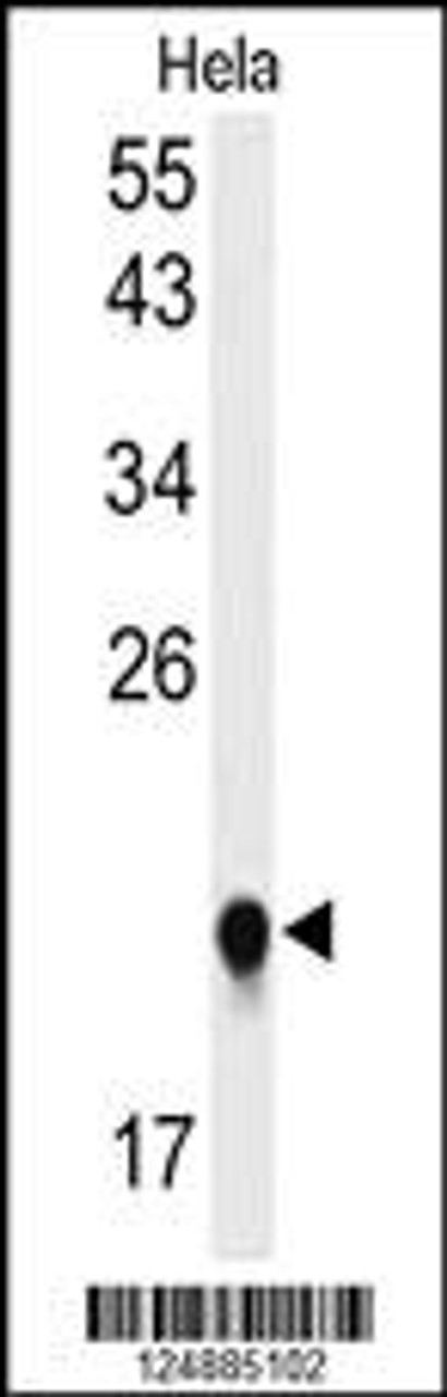 Western Blot in Hela cell line lysates (35ug/lane) . IMP3 (arrow) was detected using the purified Pab.