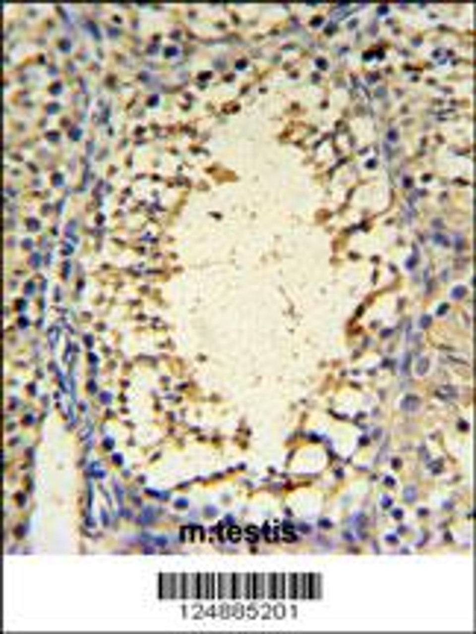 IMP3 Antibody IHC analysis in formalin fixed and paraffin embedded mouse testis tissue followed by peroxidase conjugation of the secondary antibody and DAB staining.