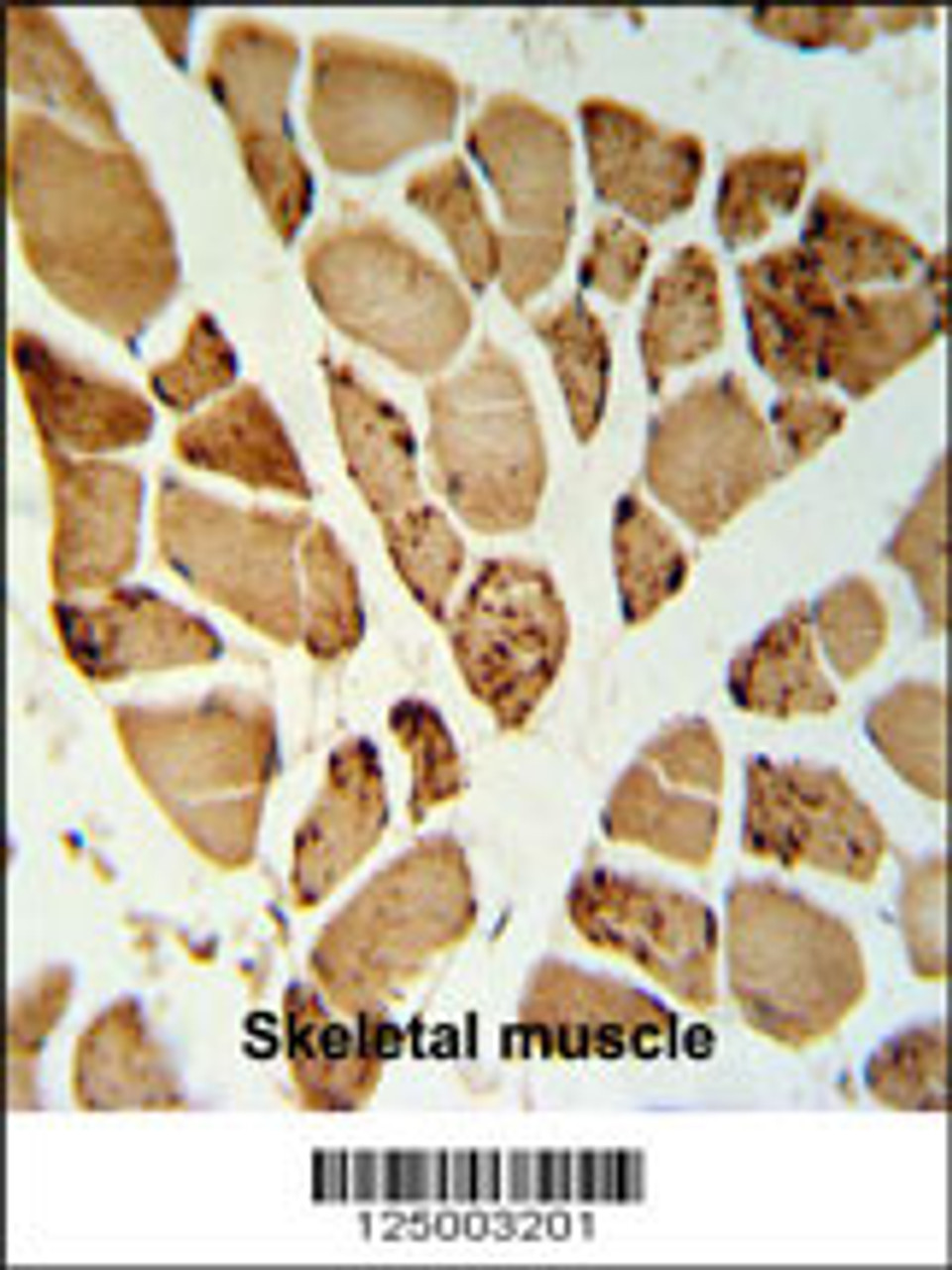 5NT1A Antibody IHC analysis in formalin fixed and paraffin embedded skeletal muscle followed by peroxidase conjugation of the secondary antibody and DAB staining.