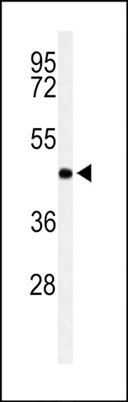 Western blot analysis of RPR1B Antibody in Jurkat cell line lysates (35ug/lane)