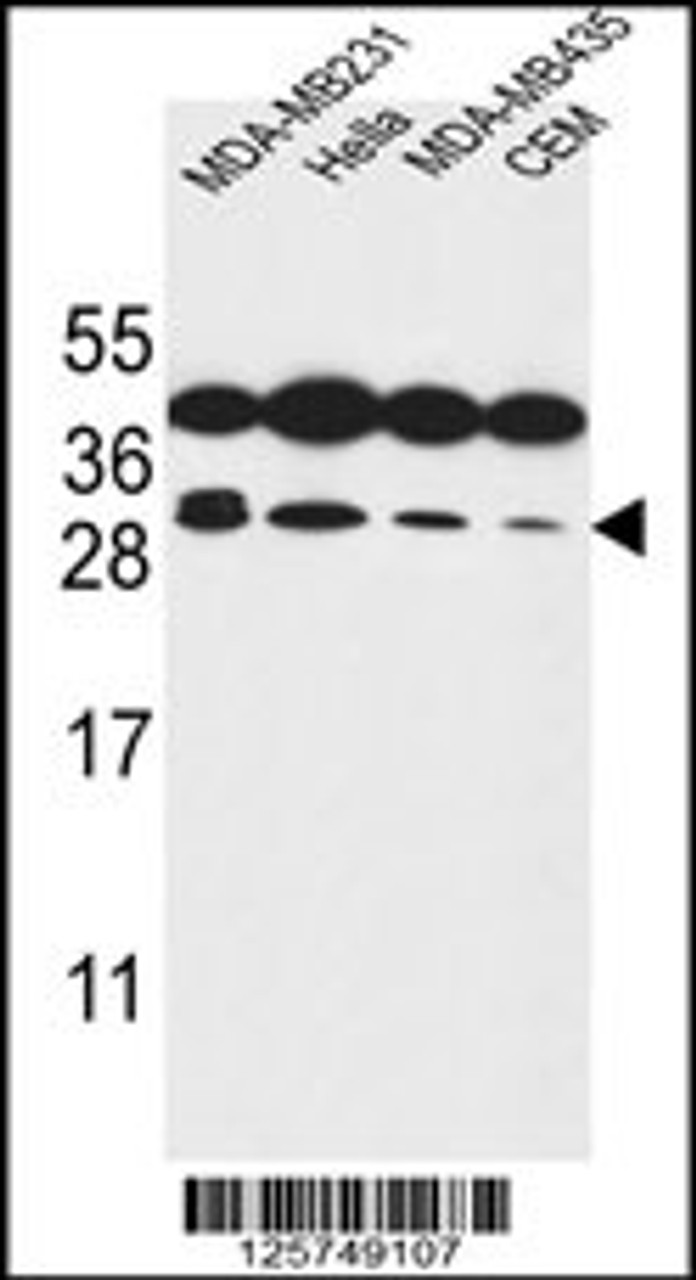 Western blot analysis in MDA-MB231, Hela, MDA-MB435, CEM cell line lysates (35ug/lane) .