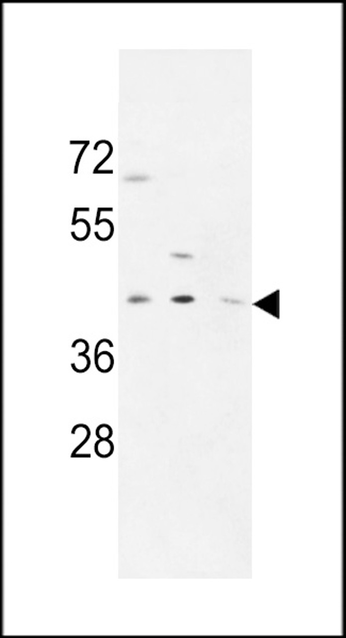 Western blot analysis in MDA-MB231, CEM, HL-60 cell line lysates (35ug/lane) .
