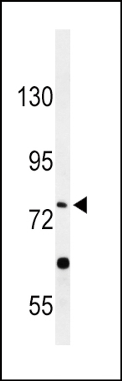 Western blot analysis of PLA2G6 Antibody in HepG2 cell line lysates (35ug/lane)