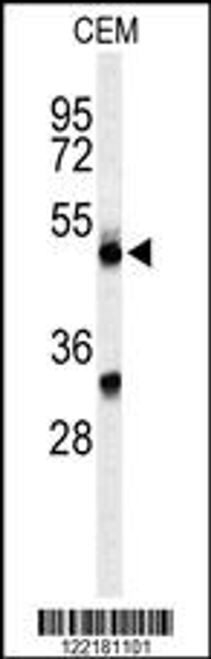 Western blot analysis of CFP Antibody in CEM cell line lysates (35ug/lane)