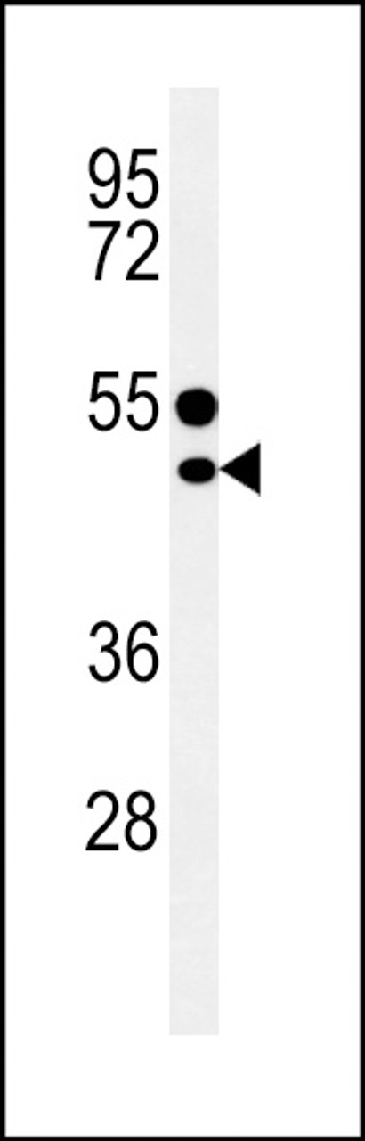 Western blot analysis in MDA-MB435 cell line lysates (35ug/lane) .