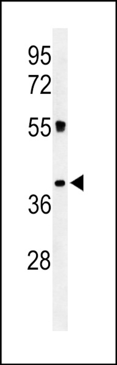Western blot analysis of CLM1 Antibody in K562 cell line lysates (35ug/lane)