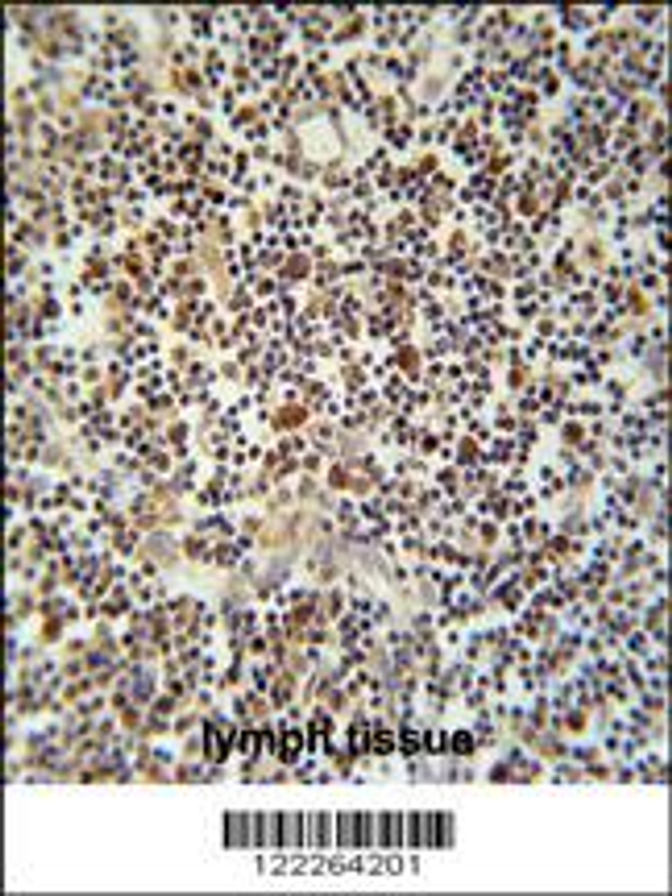 CLM1 Antibody immunohistochemistry analysis in formalin fixed and paraffin embedded human lymph tissue followed by peroxidase conjugation of the secondary antibody and DAB staining.