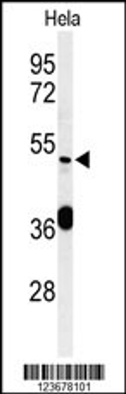 Western blot analysis of DDX49 Antibody in Hela cell line lysates (35ug/lane)