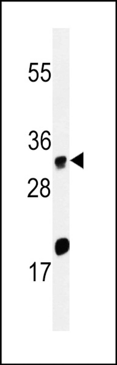 Western blot analysis of ELOVL5 Antibody in Hela cell line lysates (35ug/lane)