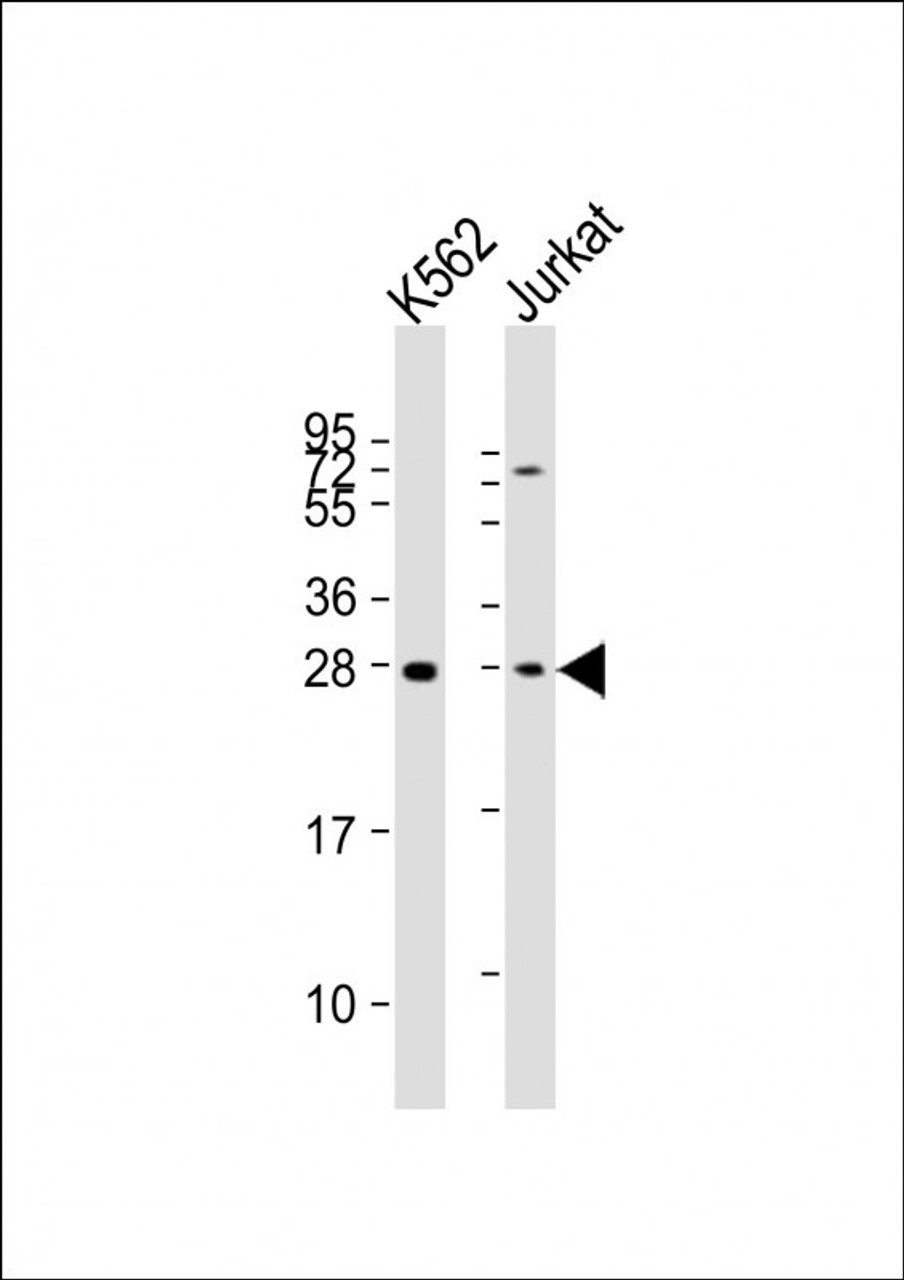 Western Blot at 1:2000 dilution Lane 1: K562 whole cell lysates Lane 2: Jurkat whole cell lysates Lysates/proteins at 20 ug per lane.