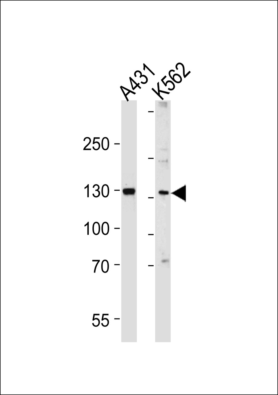 Western blot analysis of lysates from A431, K562 cell line (from left to right) , using GALNT5 Antibody at 1:1000 at each lane.