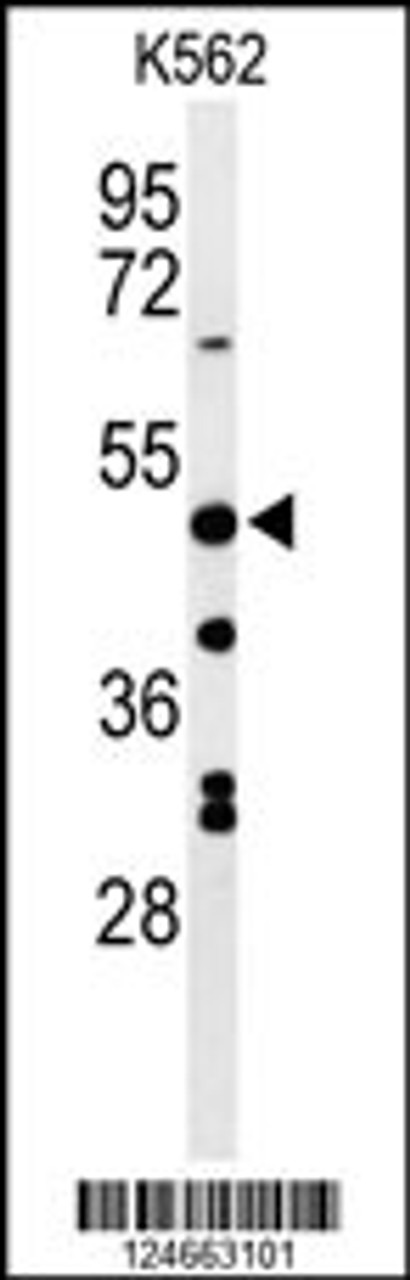 Western blot analysis of RHBG Antibody in K562 cell line lysates (35ug/lane)