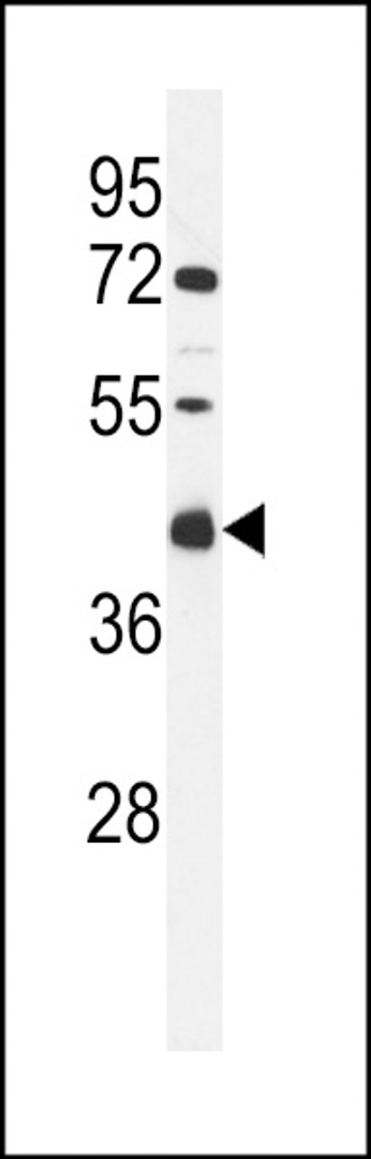 Western blot analysis of CI091 Antibody in MCF-7 cell line lysates (35ug/lane)