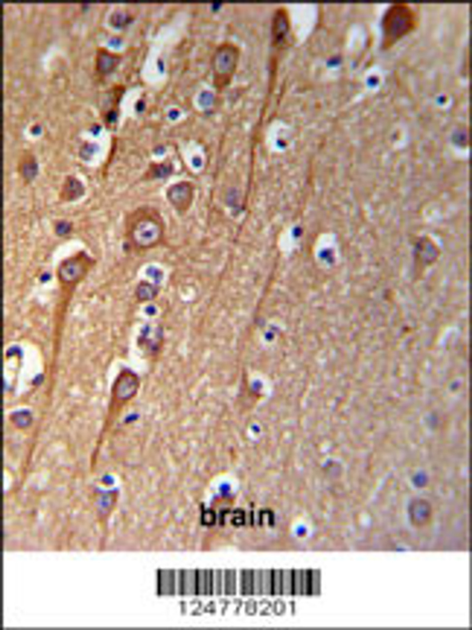 CI091 Antibody IHC analysis in formalin fixed and paraffin embedded brain tissue followed by peroxidase conjugation of the secondary antibody and DAB staining.