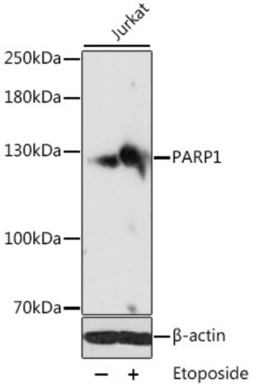 Western blot analysis of extracts of various cell lines, using PARP1 antibody (13-003) at 1:1000 dilution. Jurkat cells were treated by Etoposide (25 uM) at 37℃ for 5 hours.<br/>Secondary antibody: HRP Goat Anti-Rabbit IgG (H+L) at 1:10000 dilution.<br/>Lysates/proteins: 25ug per lane.<br/>Blocking buffer: 3% nonfat dry milk in TBST.<br/>Detection: ECL Basic Kit.<br/>Exposure time: 10s.