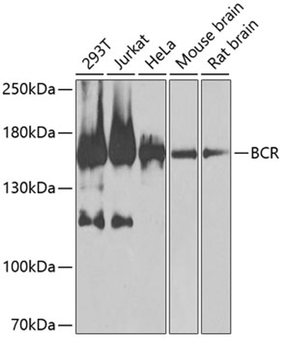 Western blot analysis of extracts of various cell lines, using BCR antibody (13-020) at 1:1000 dilution.<br/>Secondary antibody: HRP Goat Anti-Rabbit IgG (H+L) at 1:10000 dilution.<br/>Lysates/proteins: 25ug per lane.<br/>Blocking buffer: 3% nonfat dry milk in TBST.<br/>Detection: ECL Basic Kit.<br/>Exposure time: 30s.