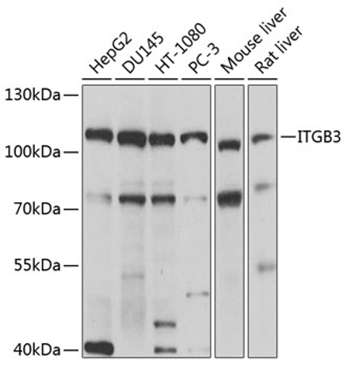 Western blot analysis of extracts of various cell lines, using ITGB3 antibody (13-023) at 1:1000 dilution.<br/>Secondary antibody: HRP Goat Anti-Rabbit IgG (H+L) at 1:10000 dilution.<br/>Lysates/proteins: 25ug per lane.<br/>Blocking buffer: 3% nonfat dry milk in TBST.<br/>Detection: ECL Basic Kit.<br/>Exposure time: 10s.