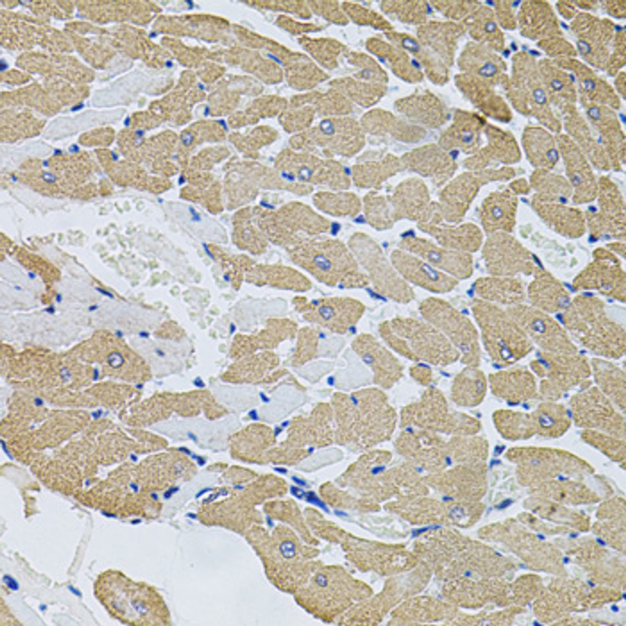 Immunohistochemistry of paraffin-embedded rat heart using CAST antibody (13-030) at dilution of 1:100 (40x lens) .