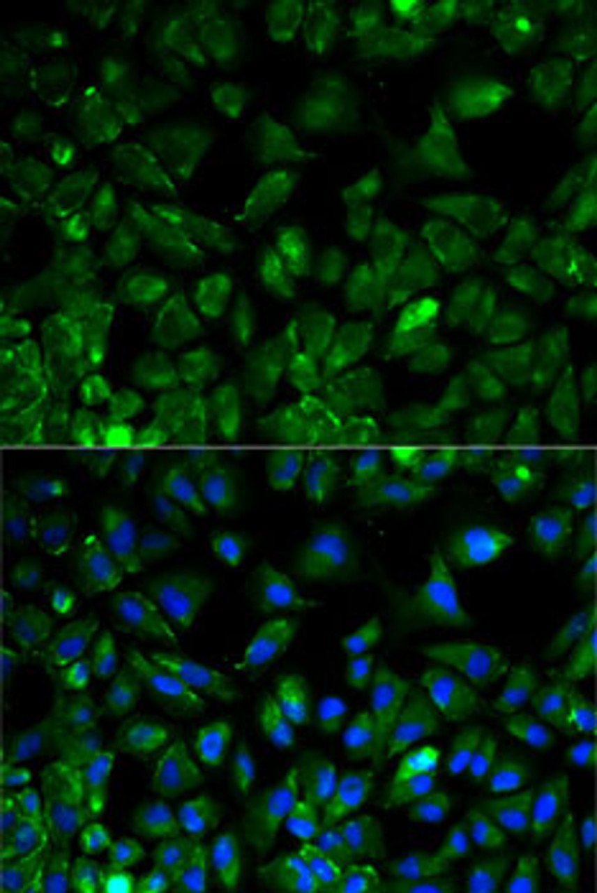 Immunofluorescence analysis of HeLa cells using EEF2 antibody (13-032) . Blue: DAPI for nuclear staining.