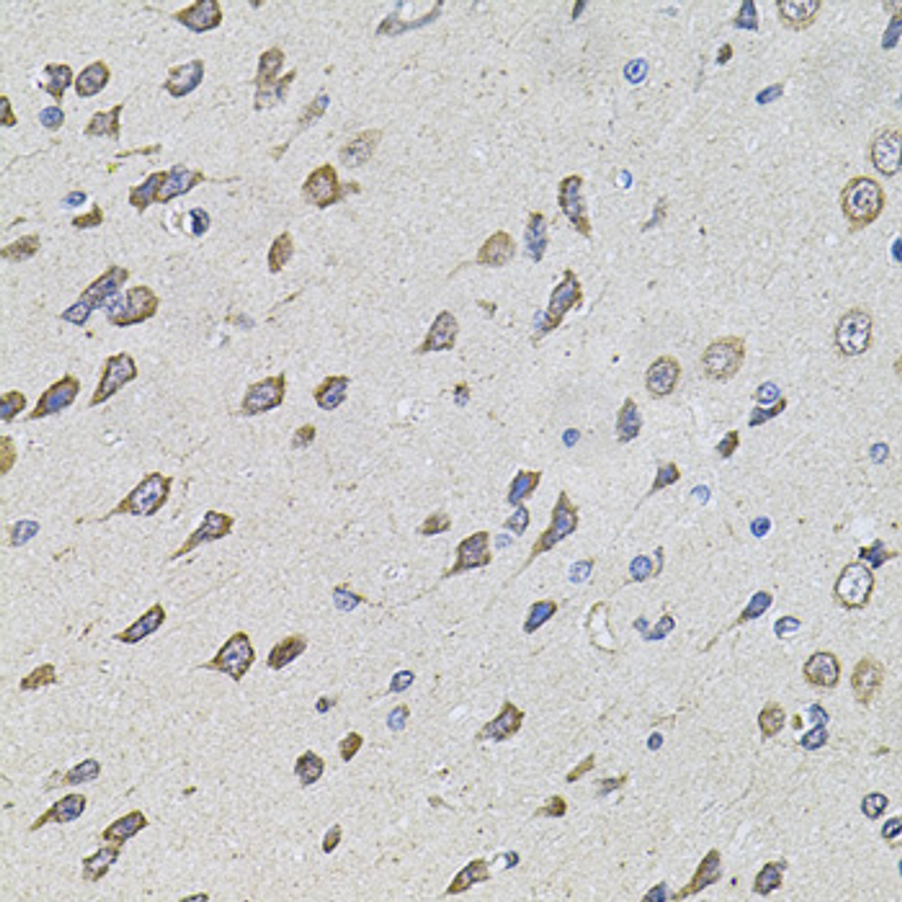 Immunohistochemistry of paraffin-embedded rat brain using FoxO3a antibody (13-033) at dilution of 1:100 (40x lens) .