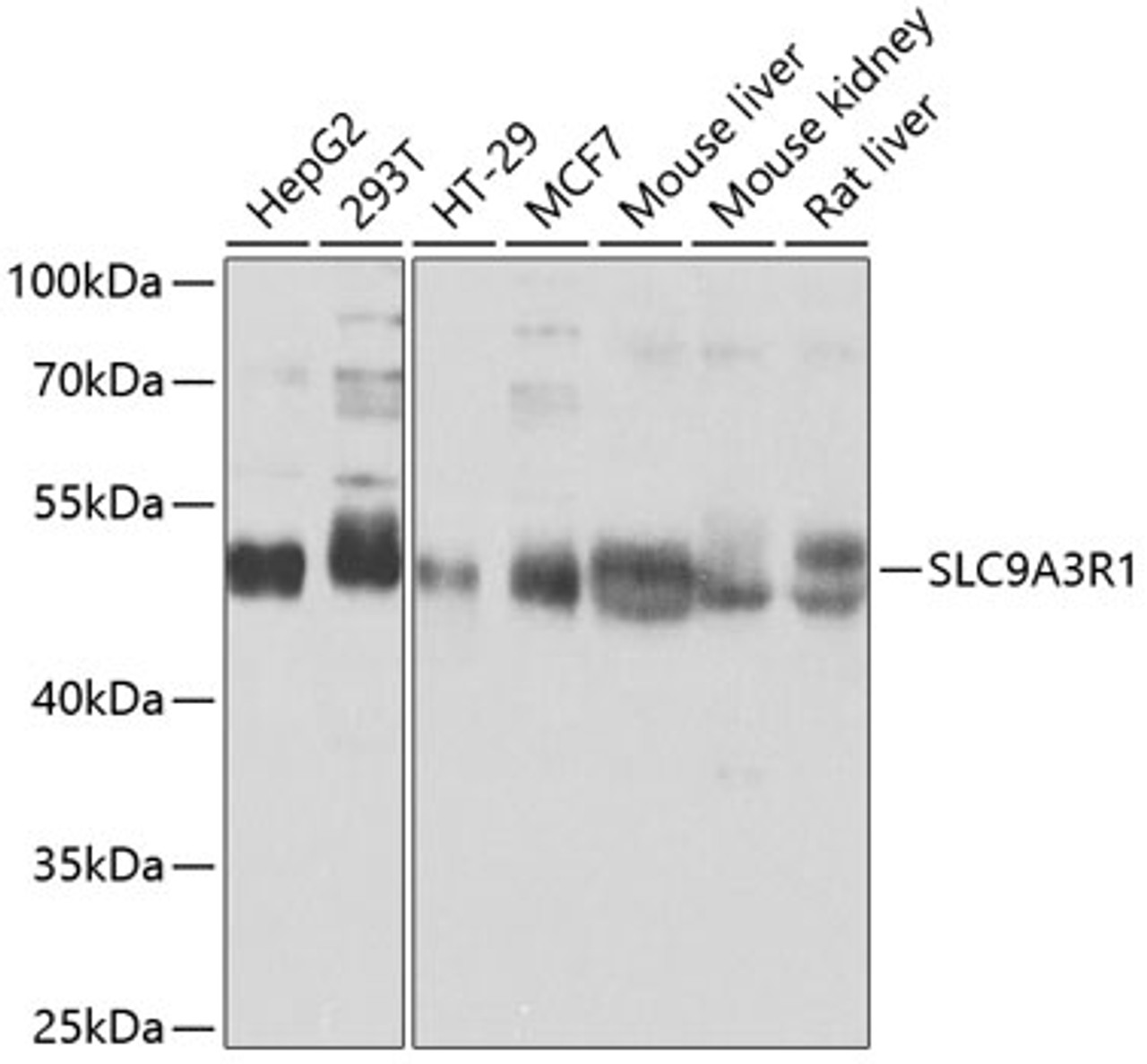 Western blot analysis of extracts of various cell lines, using SLC9A3R1 antibody (13-051) at 1:1000 dilution.<br/>Secondary antibody: HRP Goat Anti-Rabbit IgG (H+L) at 1:10000 dilution.<br/>Lysates/proteins: 25ug per lane.<br/>Blocking buffer: 3% nonfat dry milk in TBST.<br/>Detection: ECL Basic Kit.<br/>Exposure time: 1s.