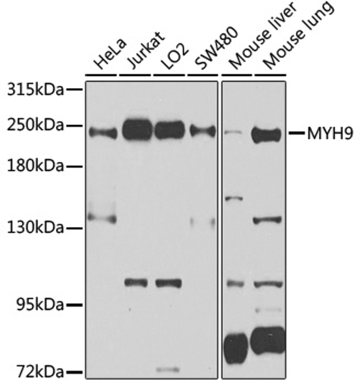 Western blot analysis of extracts of various cell lines, using MYH9 antibody (13-066) at 1:1000 dilution.<br/>Secondary antibody: HRP Goat Anti-Rabbit IgG (H+L) at 1:10000 dilution.<br/>Lysates/proteins: 25ug per lane.<br/>Blocking buffer: 3% nonfat dry milk in TBST.<br/>Detection: ECL Basic Kit.<br/>Exposure time: 15s.