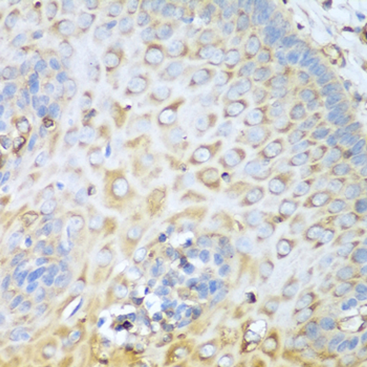 Immunohistochemistry of paraffin-embedded human esophagus using MYH9 antibody (13-066) at dilution of 1:100 (40x lens) .