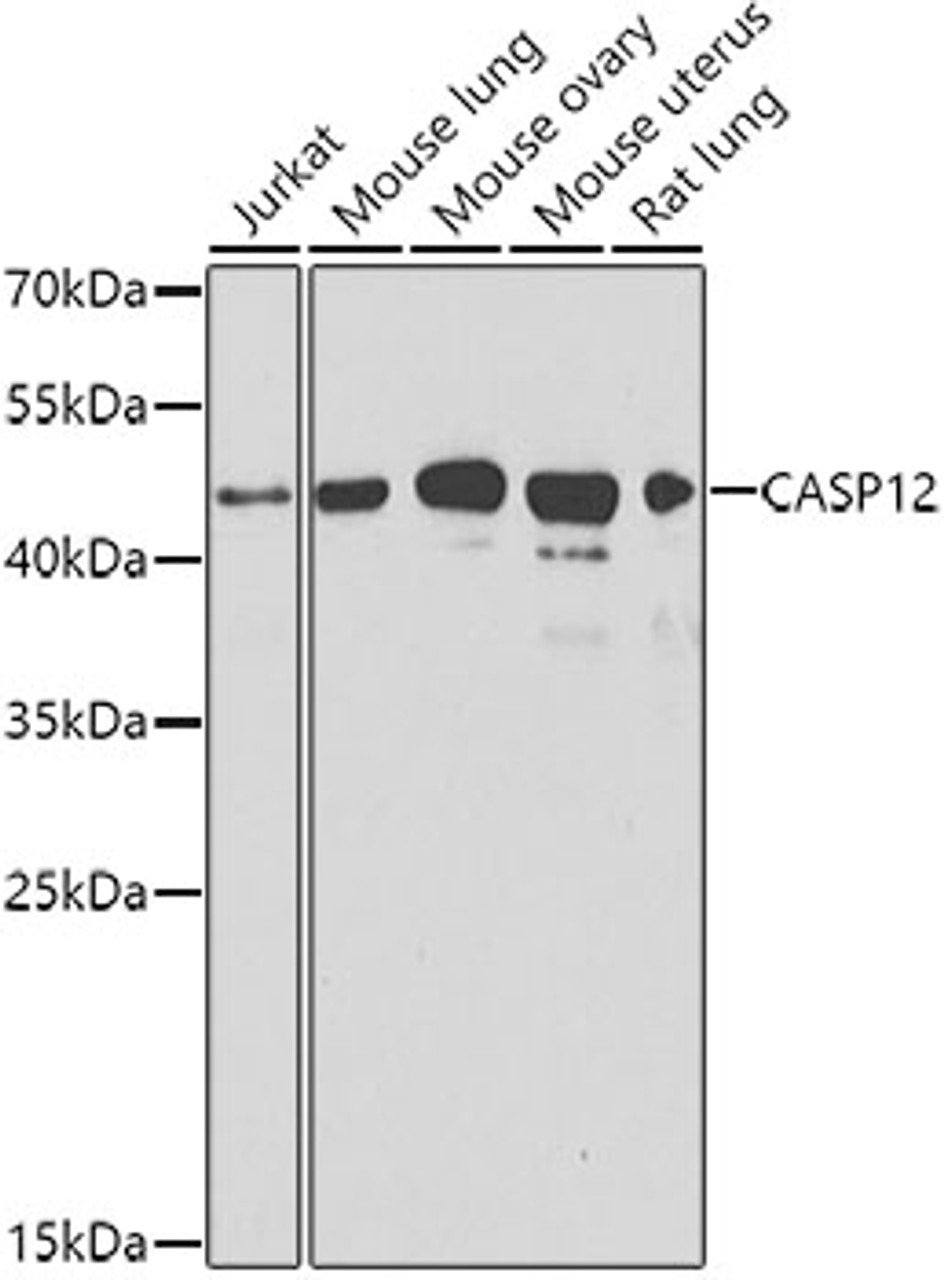 Western blot analysis of extracts of various cell lines, using CASP12 Antibody (13-082) at 1:1000 dilution.<br/>Secondary antibody: HRP Goat Anti-Rabbit IgG (H+L) at 1:10000 dilution.<br/>Lysates/proteins: 25ug per lane.<br/>Blocking buffer: 3% nonfat dry milk in TBST.<br/>Detection: ECL Basic Kit.<br/>Exposure time: 90s.