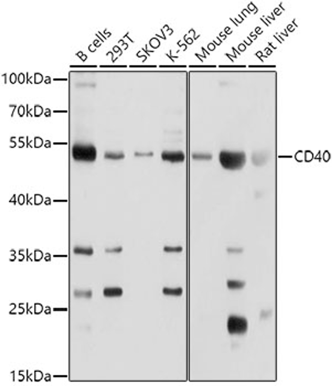 Western blot analysis of extracts of various cell lines, using CD40 Antibody (13-083) at 1:1000 dilution.<br/>Secondary antibody: HRP Goat Anti-Rabbit IgG (H+L) at 1:10000 dilution.<br/>Lysates/proteins: 25ug per lane.<br/>Blocking buffer: 3% nonfat dry milk in TBST.<br/>Detection: ECL Basic Kit.<br/>Exposure time: 5s.