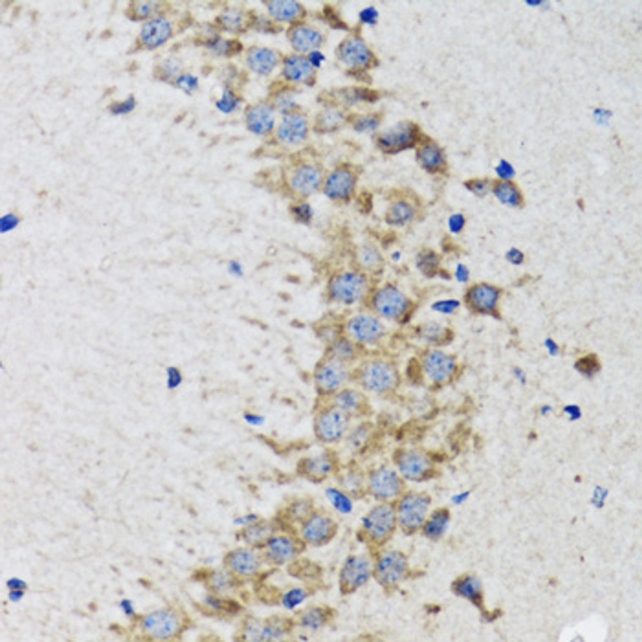 Immunohistochemistry of paraffin-embedded rat brain using CDK1 antibody (13-084) at dilution of 1:100 (40x lens) .