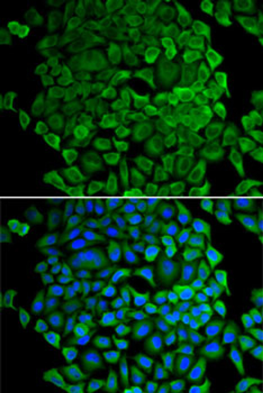 Immunofluorescence analysis of A-549 cells using Cytochrome c antibody (13-087) . Blue: DAPI for nuclear staining.