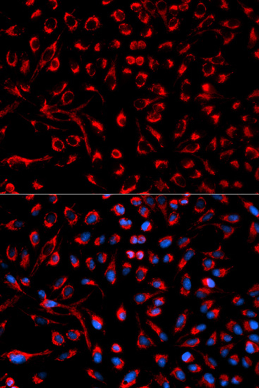 Immunofluorescence analysis of HeLa cells using DOK4 antibody (13-088) . Blue: DAPI for nuclear staining.