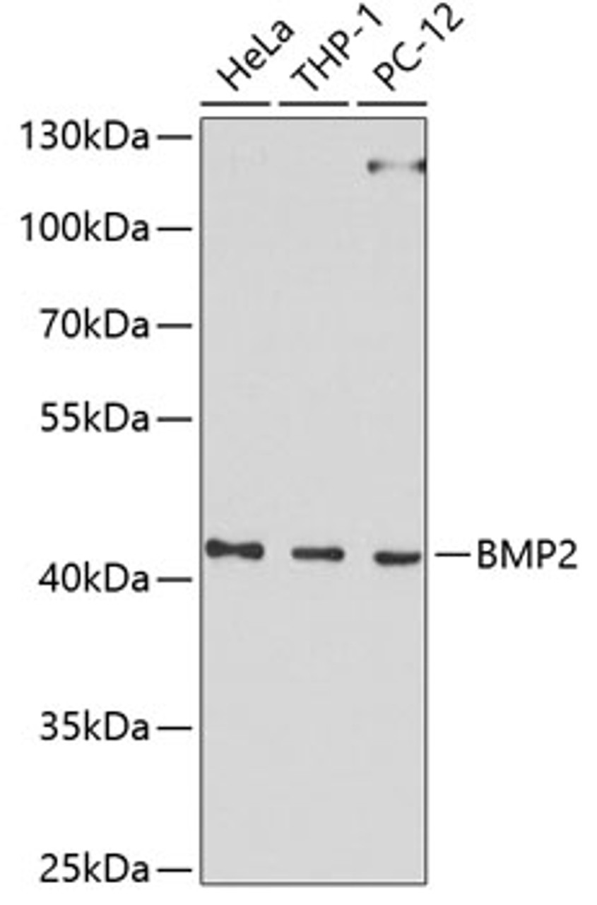 Western blot analysis of extracts of various cell lines, using BMP2 Antibody (13-091) at 1:1000 dilution.<br/>Secondary antibody: HRP Goat Anti-Rabbit IgG (H+L) at 1:10000 dilution.<br/>Lysates/proteins: 25ug per lane.<br/>Blocking buffer: 3% nonfat dry milk in TBST.<br/>Detection: ECL Basic Kit.<br/>Exposure time: 90s.