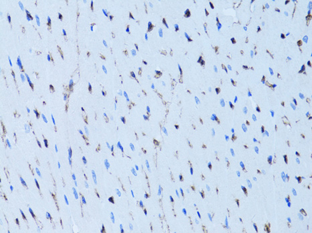 Immunohistochemistry of paraffin-embedded rat heart using FABP4 antibody (13-092) at dilution of 1:100 (40x lens) .