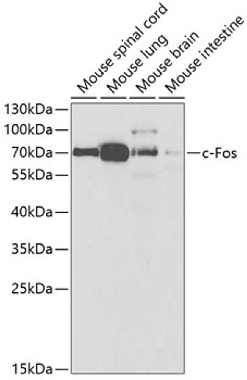 Western blot analysis of extracts of various cell lines, using c-Fos antibody (13-096) at 1:1000 dilution.<br/>Secondary antibody: HRP Goat Anti-Rabbit IgG (H+L) at 1:10000 dilution.<br/>Lysates/proteins: 25ug per lane.<br/>Blocking buffer: 3% nonfat dry milk in TBST.