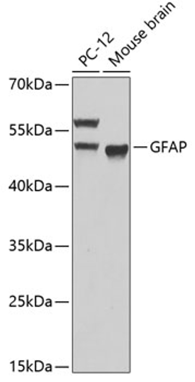 Western blot analysis of extracts of various cell lines, using GFAP antibody (13-097) at 1:1000 dilution.<br/>Secondary antibody: HRP Goat Anti-Rabbit IgG (H+L) at 1:10000 dilution.<br/>Lysates/proteins: 25ug per lane.<br/>Blocking buffer: 3% nonfat dry milk in TBST.<br/>Detection: ECL Basic Kit.<br/>Exposure time: 90s.