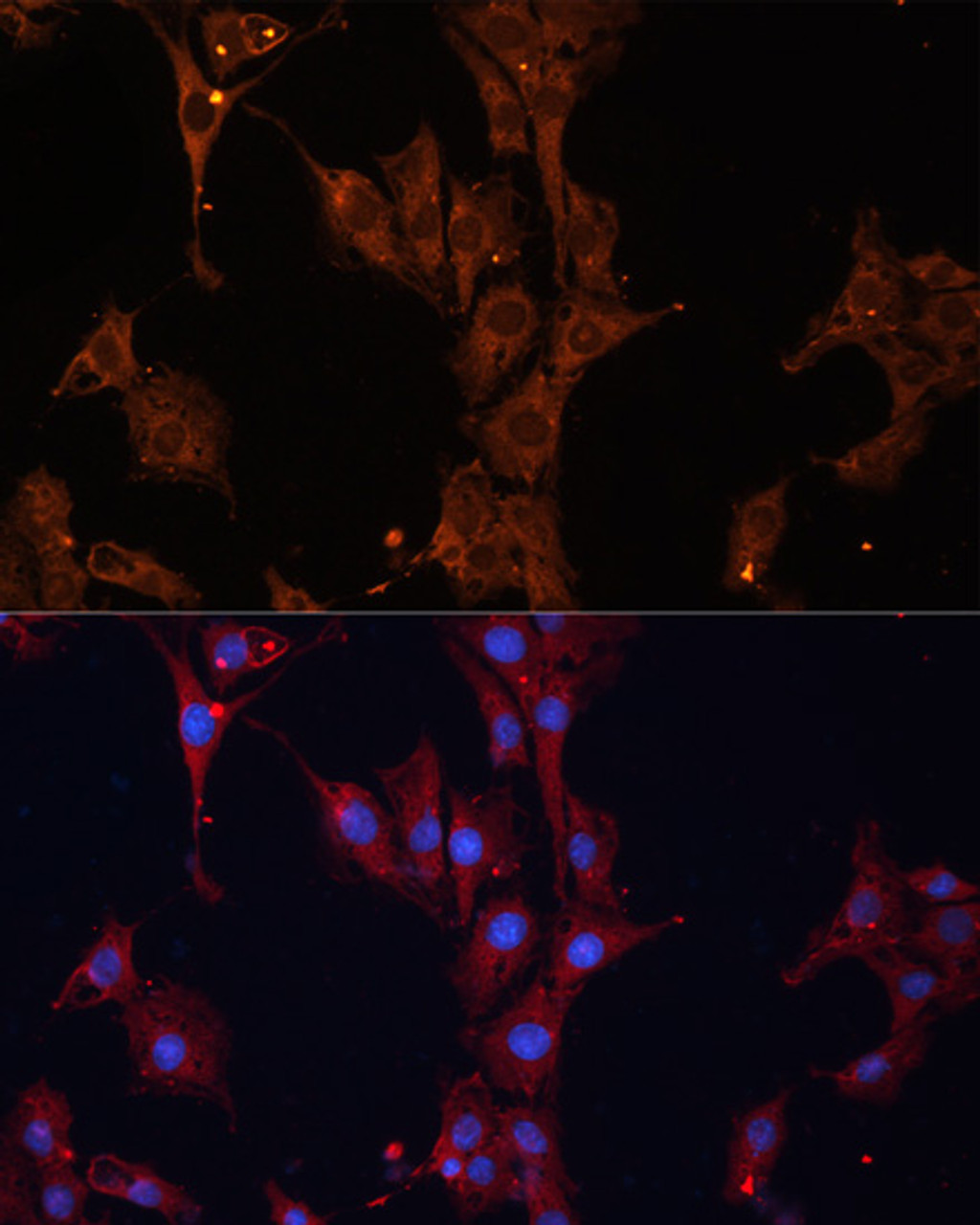 Immunofluorescence analysis of C6 cells using HSPB1 antibody (13-100) at dilution of 1:100. Blue: DAPI for nuclear staining.