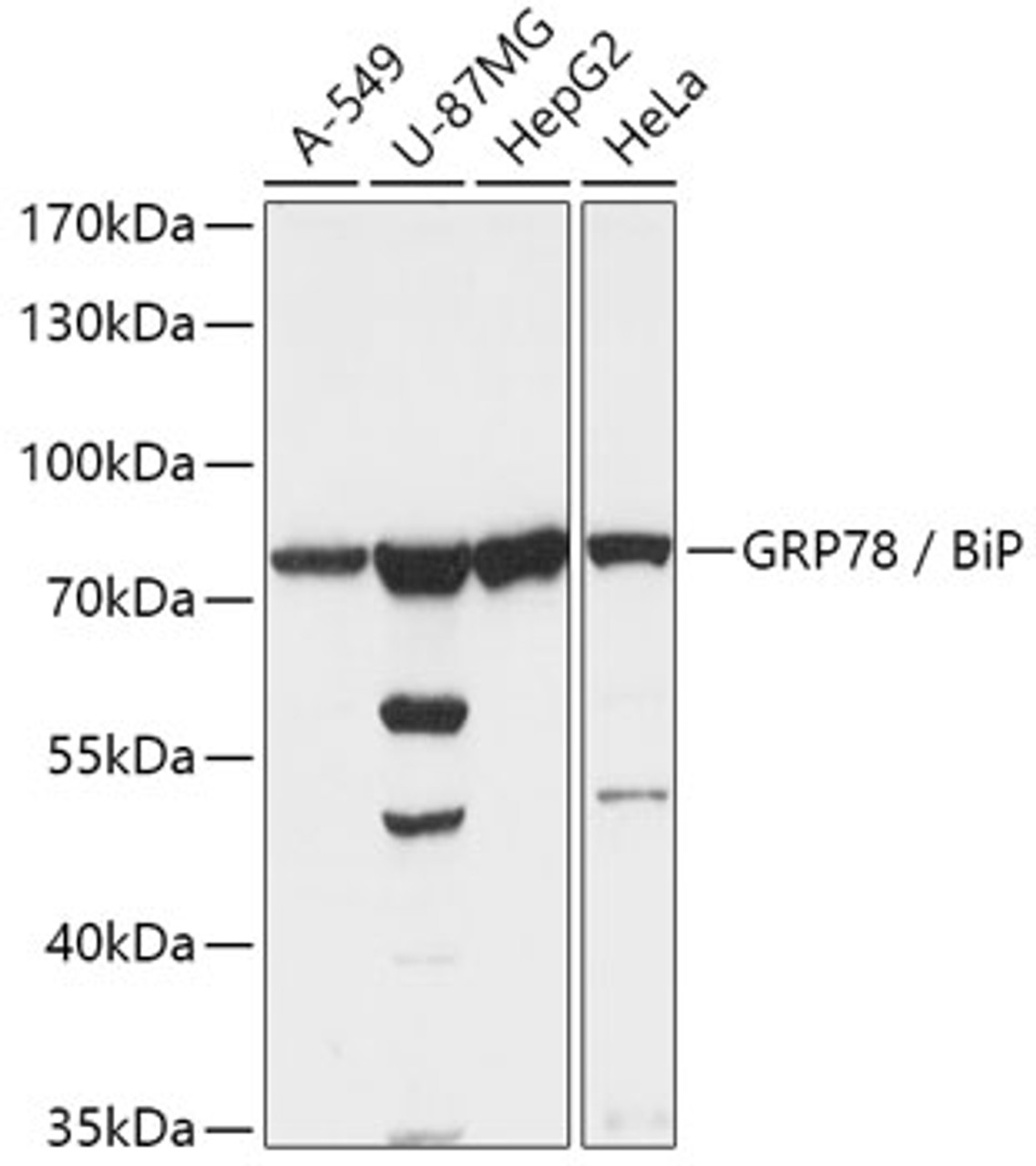 Western blot analysis of extracts of various cell lines, using HSPA5 antibody (13-101) at 1:1000 dilution.<br/>Secondary antibody: HRP Goat Anti-Rabbit IgG (H+L) at 1:10000 dilution.<br/>Lysates/proteins: 25ug per lane.<br/>Blocking buffer: 3% nonfat dry milk in TBST.<br/>Detection: ECL Basic Kit.<br/>Exposure time: 5s.