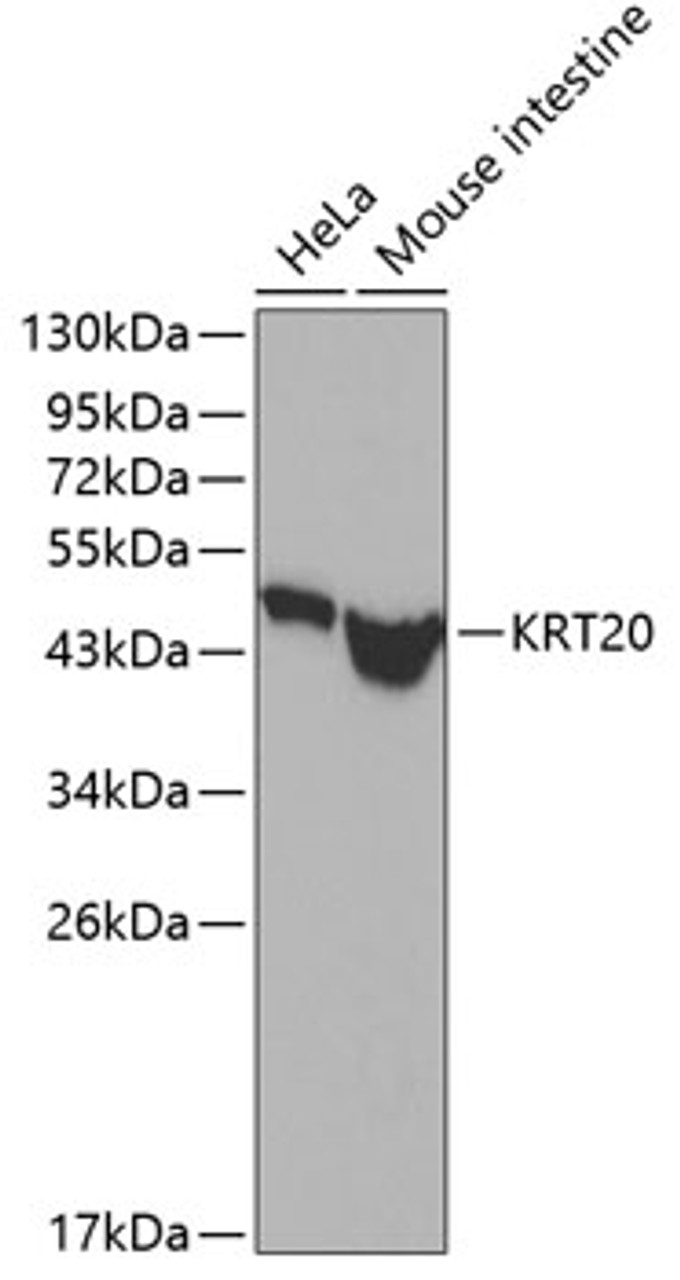 Western blot analysis of extracts of various cell lines, using KRT20 antibody (13-105) .<br/>Secondary antibody: HRP Goat Anti-Rabbit IgG (H+L) at 1:10000 dilution.<br/>Lysates/proteins: 25ug per lane.<br/>Blocking buffer: 3% nonfat dry milk in TBST.